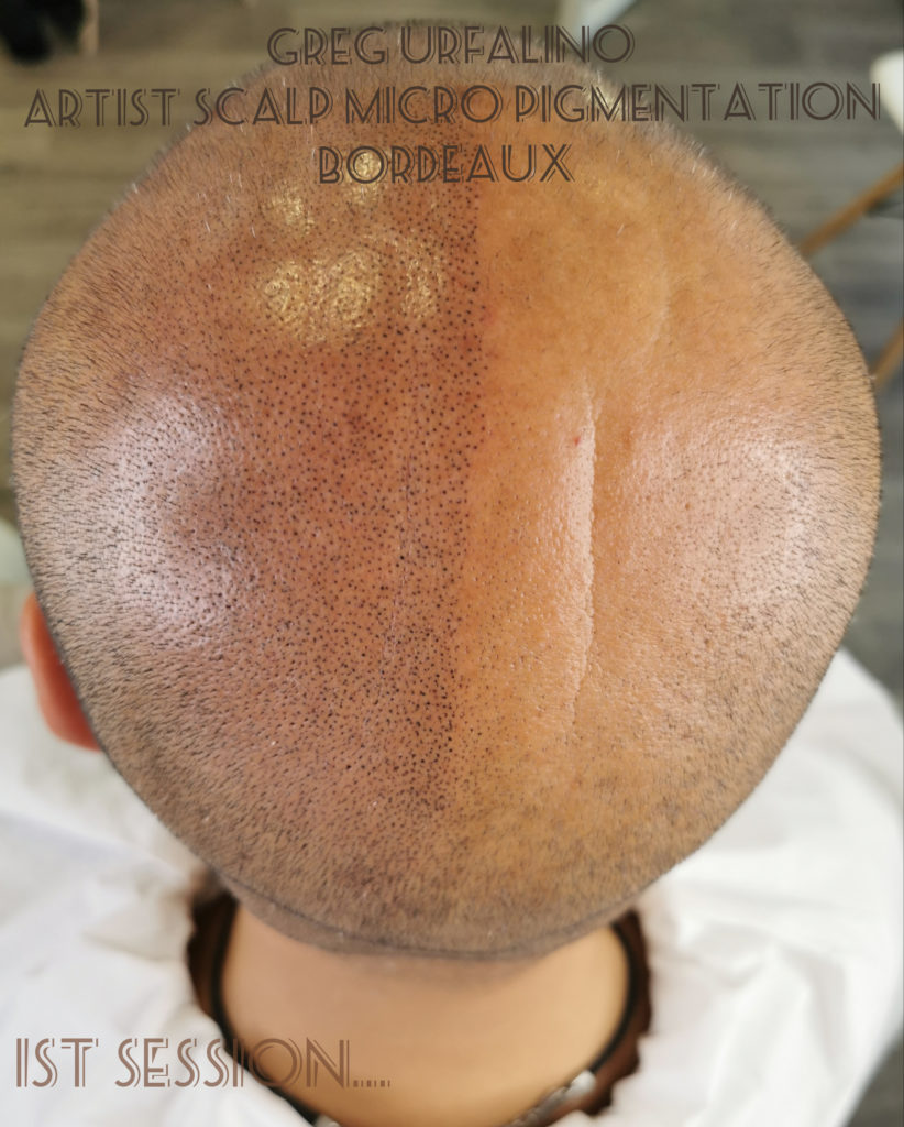 Greg Urfalino artist smp bordeaux #tricopigmentation #tricopigmentationbordeaux #smpbordeaux
