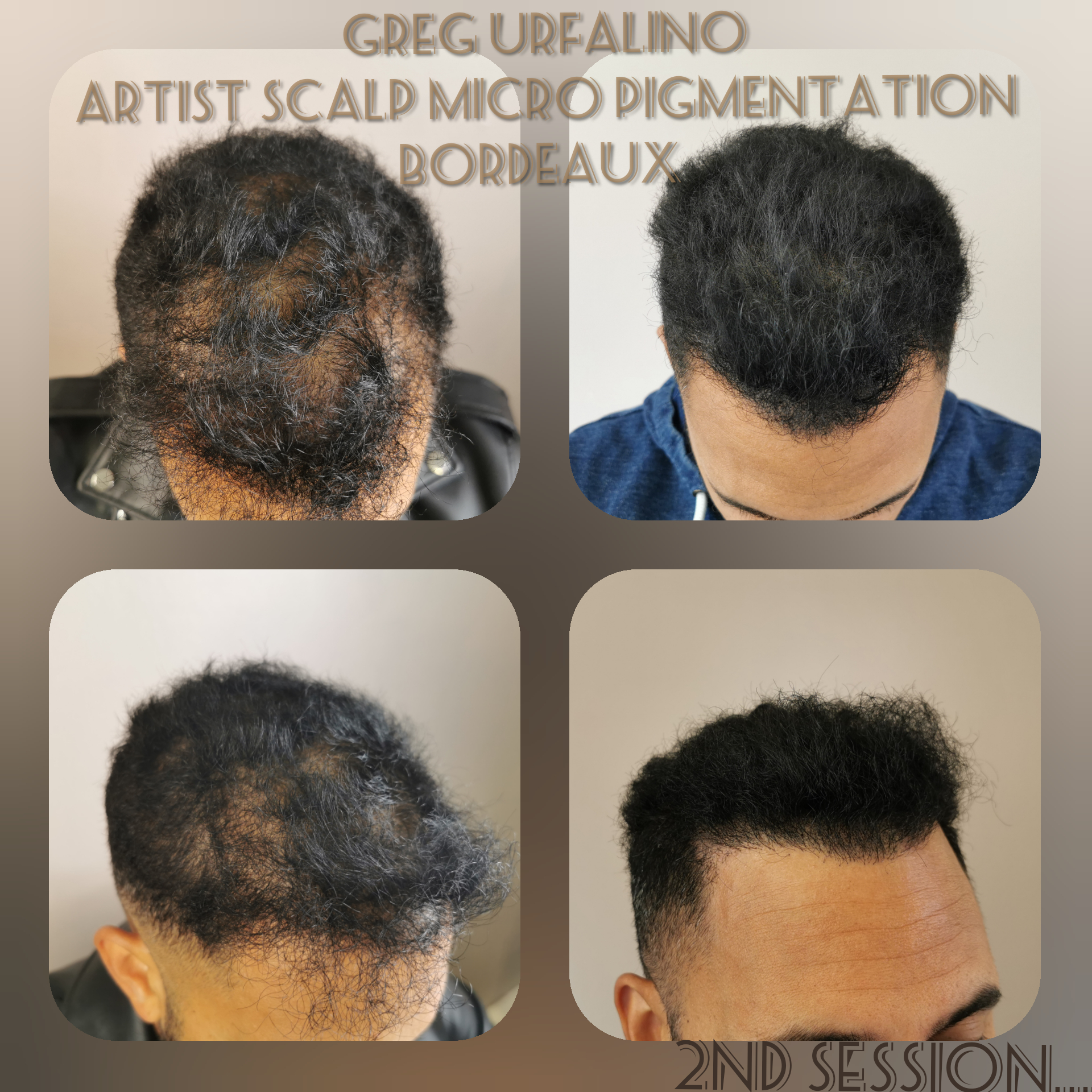 Greg Urfalino artist smp bordeaux #tricopigmentation #tricopigmentationbordeaux #smpbordeaux
