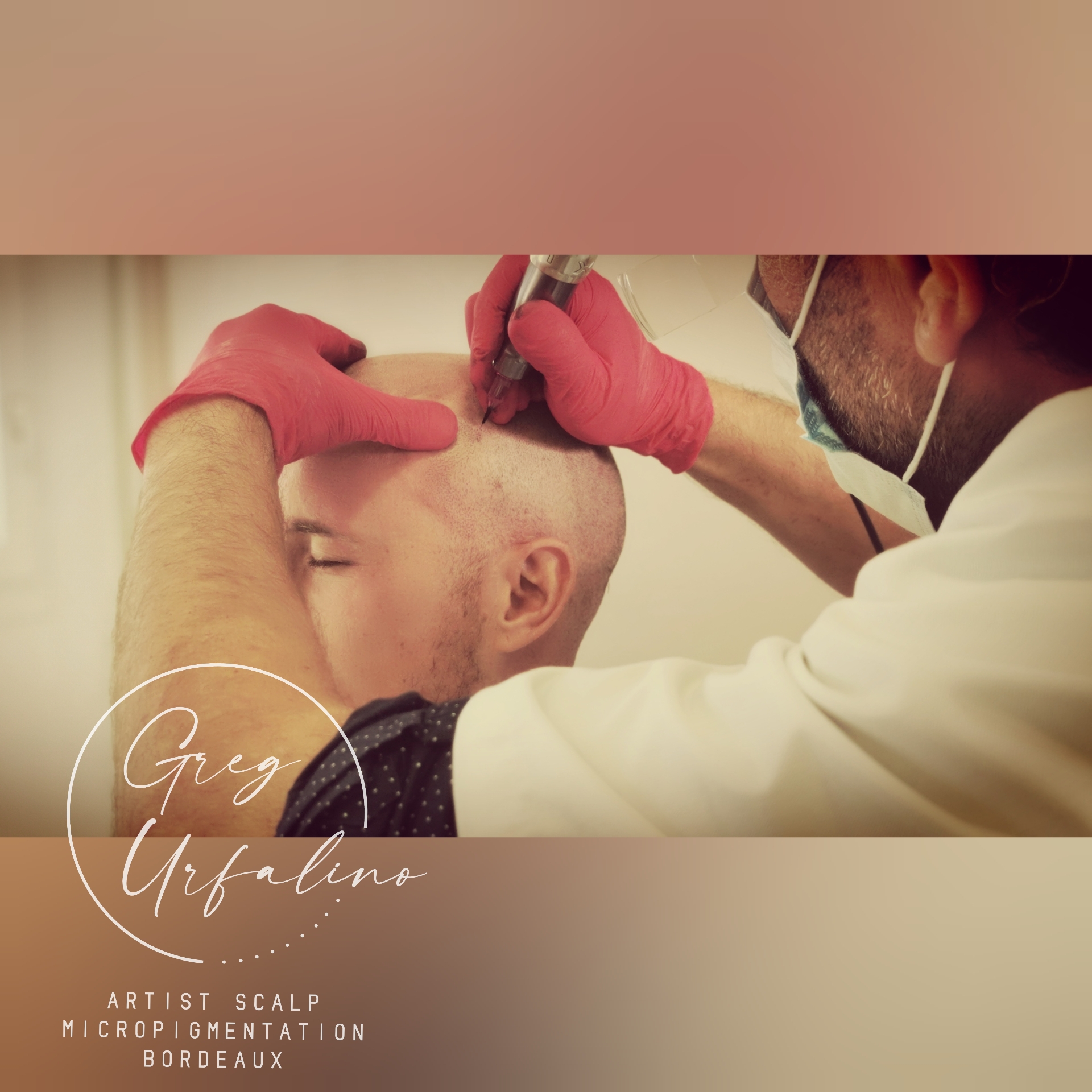 Greg Urfalino artist smp bordeaux #tricopigmentation #tricopigmentationbordeaux #smpbordeaux #dermopigmentationcapillaire #artisttatoo #bordeaux #tricopigmentationfrance #tatouagecuirchevelu #smp #pigmentbioresorbable #greffecapillaire