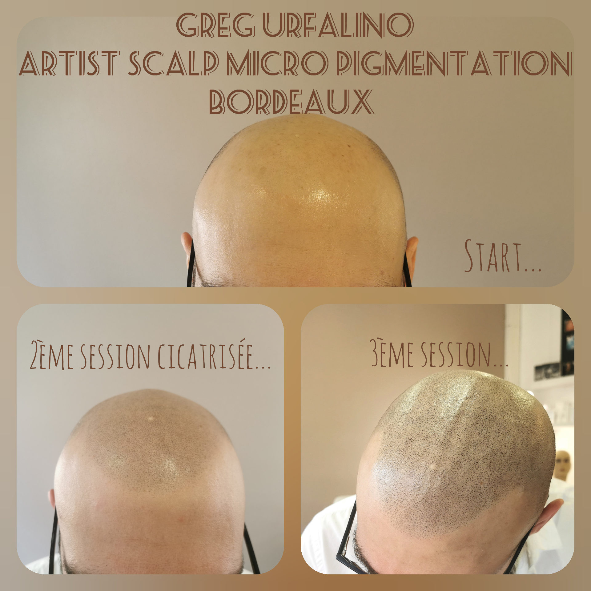 Greg Urfalino artist smp bordeaux #tricopigmentation #tricopigmentationbordeaux #smpbordeaux