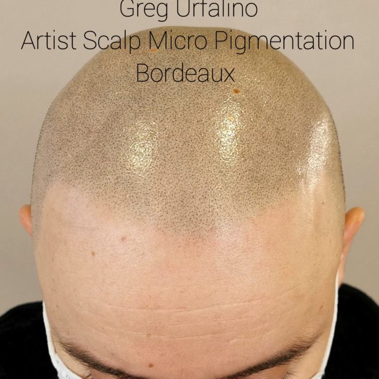 Greg Urfalino artist smp bordeaux #tricopigmentation #tricopigmentationbordeaux #smpbordeaux #tricopigmentation #artisttatoo #bordeaux