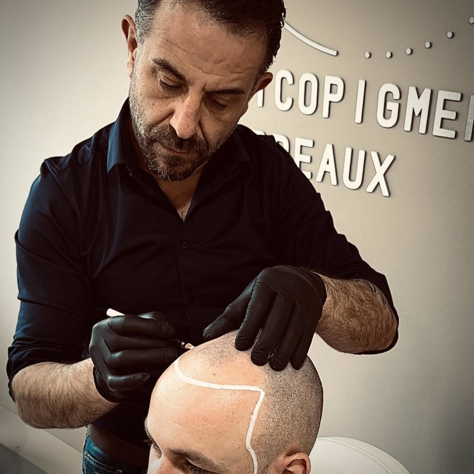 Greg Urfalino TRICOPIGMENTATION BORDEAUX #tricopigmentation #tricopigmentationbordeaux #smpbordeaux #dermopigmentationcapillaire #artisttatoo #bordeaux #tatouagecuirchevelu #smp #pigmentbioresorbable #greffedecheveux #tricopigmentationfrance #dermopigmentation